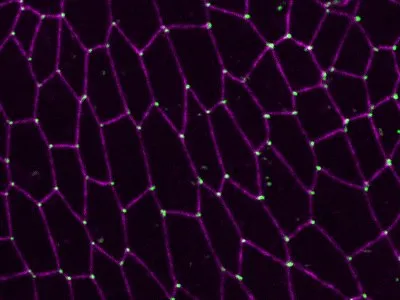 tricellular junctions in the fly embryonic epithelia are labelled with green while bicellular junction in magenta